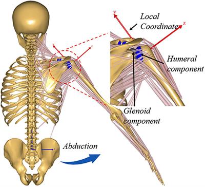 Effect of Rotator Cuff Deficiencies on Muscle Forces and Glenohumeral Contact Force After Anatomic Total Shoulder Arthroplasty Using Musculoskeletal Multibody Dynamics Simulation